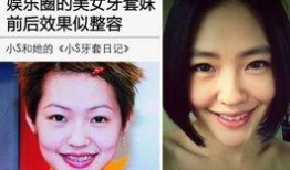 娱乐圈爆料卡通牙套,卡通牙套引领娱乐圈新潮流